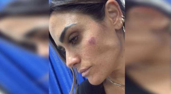 Alessandra Rojo de la Vega denuncia agresión durante operativo en la San Rafael