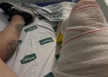 Tragedia en el gimnasio: Fisicoculturista sufre grave lesión al intentar cargar 400 kilos